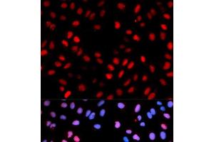 Immunofluorescence analysis of U2OS cells using Phospho-RAF1(S621) Polyclonal Antibody (RAF1 antibody  (pSer621))