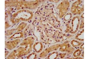 IHC image of ABIN7145800 diluted at 1:800 and staining in paraffin-embedded human kidney tissue performed on a Leica BondTM system. (BAZ2B antibody  (AA 139-240))