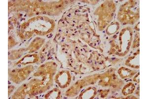 IHC image of ABIN7145800 diluted at 1:800 and staining in paraffin-embedded human kidney tissue performed on a Leica BondTM system.