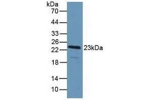 Detection of PDCD6 in Human Hela Cells using Polyclonal Antibody to Programmed Cell Death Protein 6 (PDCD6) (PDCD6 antibody  (AA 32-191))