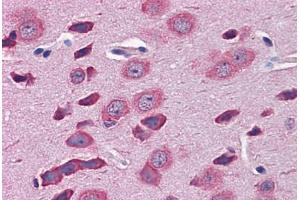 Mouse Brain: Formalin-Fixed, Paraffin-Embedded (FFPE) (TBR1 antibody  (AA 51-100))