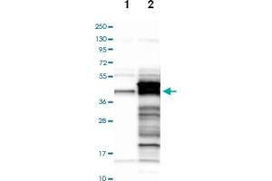 Western blot analysis of Lane 1: Negative control (vector only transfected HEK293T lysate), Lane 2: Over-expression lysate (Co-expressed with a C-terminal myc-DDK tag (~3. (Syntaxin 18 antibody)
