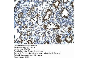 Human Lung (NAC1 antibody  (Middle Region))