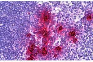 Human Thymus, Myeloid Cells: Formalin-Fixed, Paraffin-Embedded (FFPE) (alpha Defensin 1 antibody  (AA 50-63))