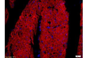 Formalin-fixed and paraffin embedded rat heart tissue labeled with Rabbit Anti-DOG-1/TMEM16A Polyclonal Antibody, Unconjugated at 1:200 followed by conjugation to the secondary antibody and DAB staining. (ANO1 antibody  (AA 151-250))