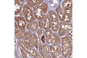 Immunohistochemical staining of human kidney shows moderate cytoplasmic positivity in tubular cells. (FZD8 antibody)