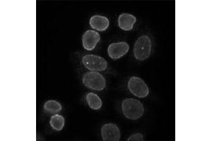 Indirect immunofluorescence staining of HeLa cells with Lbr polyclonal antibody . (Lamin B Receptor antibody)