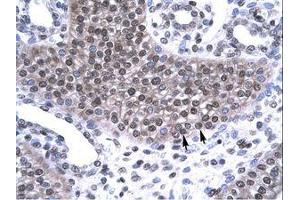 Image no. 1 for anti-TAF15 RNA Polymerase II, TATA Box Binding Protein (TBP)-Associated Factor, 68kDa (TAF15) (AA 42-91) antibody (ABIN6735812)