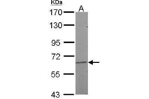 Western Blotting (WB) image for anti-Nuclear Receptor Subfamily 5, Group A, Member 2 (NR5A2) antibody (ABIN2856246)