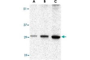 Western blot analysis of BCL2A1 in human kidney tissue lysate with BCL2A1 polyclonal antibody  at (A) 0. (BCL2A1 antibody  (C-Term))