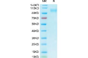 Biotinylated Human ACE2 on Tris-Bis PAGE under reduced condition. (ACE2 Protein (His-Avi Tag,Biotin))