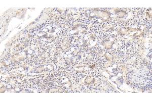 Detection of IL17 in Porcine Small intestine Tissue using Monoclonal Antibody to Interleukin 17 (IL17) (IL-17 antibody  (AA 25-153))