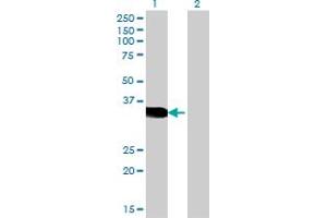 Western Blot analysis of CRX expression in transfected 293T cell line by CRX monoclonal antibody (M06), clone 4A12.