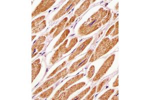 Antibody staining PDK4 in human heart tissue sections by Immunohistochemistry (IHC-P - paraformaldehyde-fixed, paraffin-embedded sections). (PDK4 antibody  (C-Term))