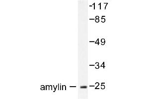 Image no. 1 for anti-Islet Amyloid Polypeptide (IAPP) antibody (ABIN271869) (Amylin/DAP antibody)
