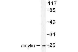 Image no. 1 for anti-Islet Amyloid Polypeptide (IAPP) antibody (ABIN271869) (Amylin/DAP antibody)