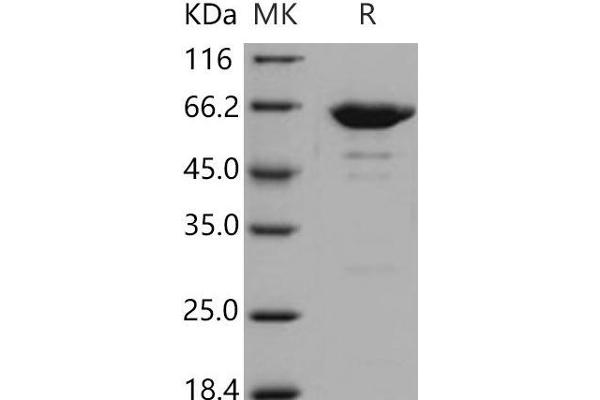 LTA4H Protein (His tag)