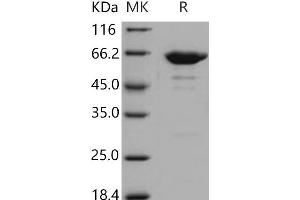 Western Blotting (WB) image for Leukotriene A4 Hydrolase (LTA4H) (Active) protein (His tag) (ABIN7320340) (LTA4H Protein (His tag))
