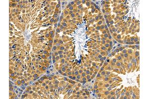 ABIN6259321 and ABIN6274774 at 1/100 staining Mouse testis tissue by IHC-P. (RPL26L antibody  (C-Term))