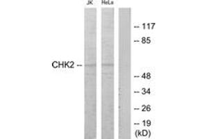 Western blot analysis of extracts from Jurkat  and HeLa cells treated with  etoposide 25uM 24hours, using Chk2 (Ab-68) Antibody. (CHEK2 antibody  (AA 35-84))