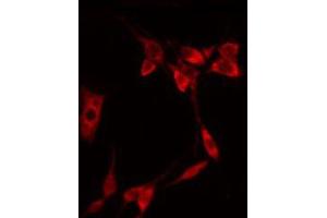 ABIN6267322 staining NIH-3T3 by IF/ICC. (EIF4E antibody  (pSer209))