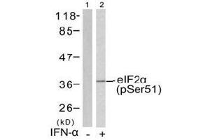 Image no. 1 for anti-Eukaryotic Translation Initiation Factor 2 Subunit 1 (EIF2S1) (pSer51) antibody (ABIN197047) (EIF2S1 antibody  (pSer51))