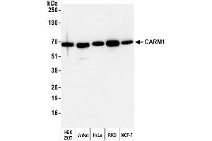 Western Blotting (WB) image for anti-Coactivator-Associated Arginine Methyltransferase 1 (CARM1) (C-Term) antibody (ABIN7454627) (CARM1 antibody  (C-Term))
