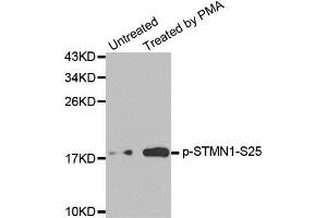 Western blot analysis of extracts from Jurkat cells, using Phospho-STMN1-S25 antibody. (Stathmin 1 antibody  (pSer25))