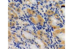 Used in DAB staining on fromalin fixed paraffin-embedded stomach tissue (SIRT3 antibody  (AA 126-399))