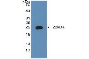 Detection of Recombinant BAD, Human using Polyclonal Antibody to Bcl2 Associated Death Promoter (BAD) (BAD antibody  (AA 1-168))