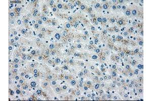 Image no. 2 for anti-Checkpoint Kinase 2 (CHEK2) antibody (ABIN1497500) (CHEK2 antibody)