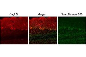 Expression of CaV2. (CACNA1E antibody  (Intracellular))