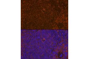 Immunofluorescence analysis of rat spleen using WASP Rabbit mAb (ABIN7271381) at dilution of 1:100 (40x lens). (WASP antibody)