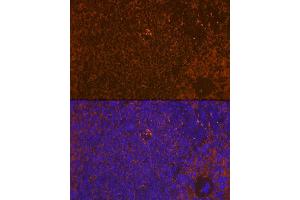 Immunofluorescence analysis of rat spleen using WASP Rabbit mAb (ABIN7271381) at dilution of 1:100 (40x lens). (WASP antibody)