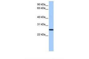 Image no. 1 for anti-F-Box Protein 36 (FBXO36) (AA 32-81) antibody (ABIN6739395) (FBXO36 antibody  (AA 32-81))