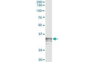 Immunoprecipitation of PRSS21 transfected lysate using anti-PRSS21 monoclonal antibody and Protein A Magnetic Bead , and immunoblotted with PRSS21 MaxPab rabbit polyclonal antibody. (PRSS21 antibody  (AA 121-220))