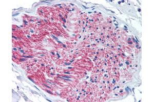 Anti-P2RX7 / P2X7 antibody IHC of human pancreas, nerve. (P2RX7 antibody  (Internal Region))
