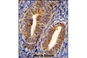 Immunohistochemistry (Paraffin-embedded Sections) (IHC (p)) image for anti-Dipeptidyl-Peptidase 3 (DPP3) (AA 583-612), (C-Term) antibody (ABIN655179)