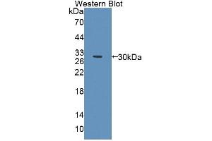 Figure. (ABCA2 antibody  (AA 2201-2436))