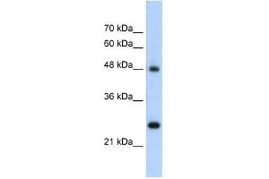 Chromogranin A antibody used at 5 ug/ml to detect target protein.