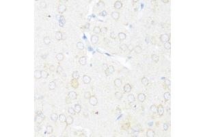 Immunohistochemistry of paraffin-embedded rat brain using EIF3J antibody. (EIF3S1 antibody  (AA 1-258))