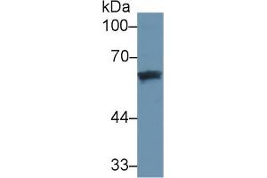 Detection of DBP in Human Lung lysate using Monoclonal Antibody to Vitamin D Binding Protein (DBP) (Vitamin D-Binding Protein antibody  (AA 209-401))