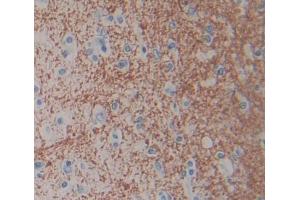 Used in DAB staining on fromalin fixed paraffin- embedded brain tissue (Cnpase antibody  (AA 186-421))