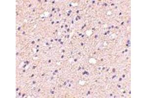 Immunohistochemistry of ELOVL6 in human brain with ELOVL6 antibody at 5 μg/ml. (ELOVL6 antibody  (N-Term))