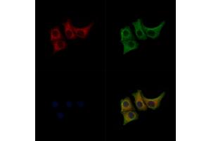 ABIN7093102 and ABIN7097256 staining Hela cells(heat shock treatment) by IF/ICC. (MLKL antibody  (pSer352))