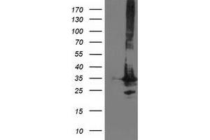 Image no. 1 for anti-Phenylethanolamine N-Methyltransferase (PNMT) antibody (ABIN1500306) (PNMT antibody)