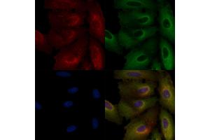 ABIN6265394 and ABIN6266638 staining  cells by IF/ICC. (Synaptophysin antibody  (Internal Region))