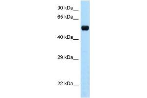 WB Suggested Anti-Tapbpl Antibody Titration: 1. (TAPBPL antibody  (N-Term))