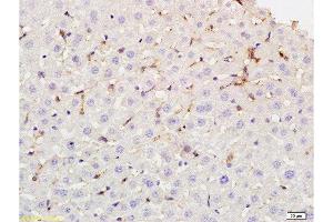 Formalin-fixed and paraffin embedded rat liver tissue labeled with Rabbit Anti-phospho-CD32B(Tyr292) Polyclonal Antibody at 1:200 followed by conjugation to the secondary antibody and DAB staining. (FCGR2B antibody  (pTyr292))