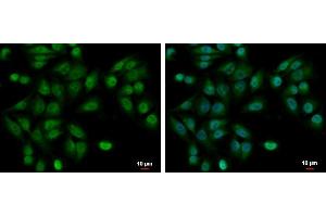 ICC/IF Image UBE2A antibody detects UBE2A protein at cytoplasm and nucleus by immunofluorescent analysis. (UBE2A antibody)
